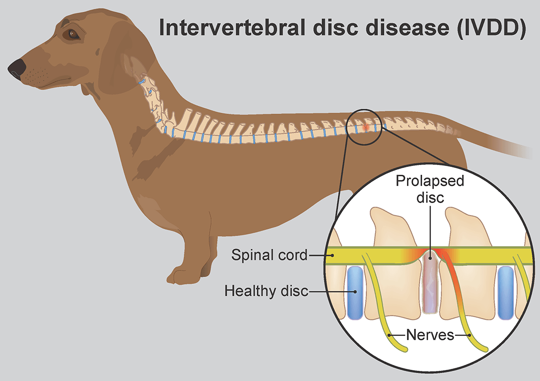 Intervertebral Disc Disease (IVDD)